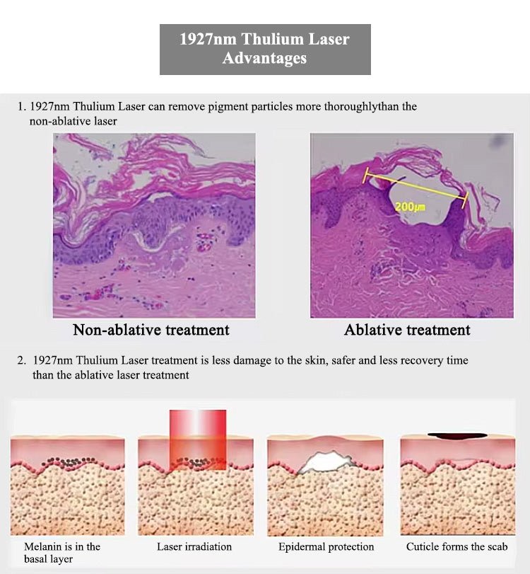 1927nm Fractional Thulium Laser Skin Rejuvenation Pigmentation Removal Machine - CSTrueBeauty