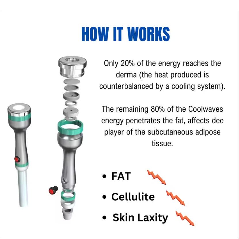 2.45 GHz Coolwaves Body Shaping Device Non - Invasive Fat Reduction and Skin Tightening - CSTrueBeauty