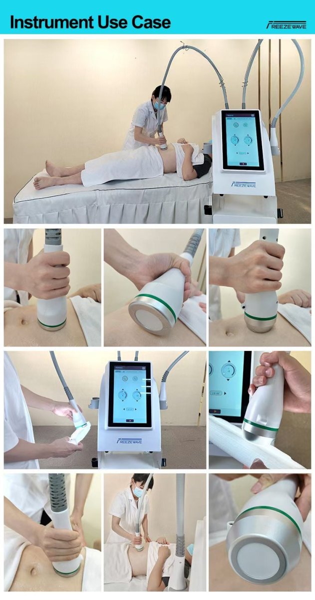 FREEZEWAVE Non - Invasive Microwave Body Contouring Machine - CSTrueBeauty