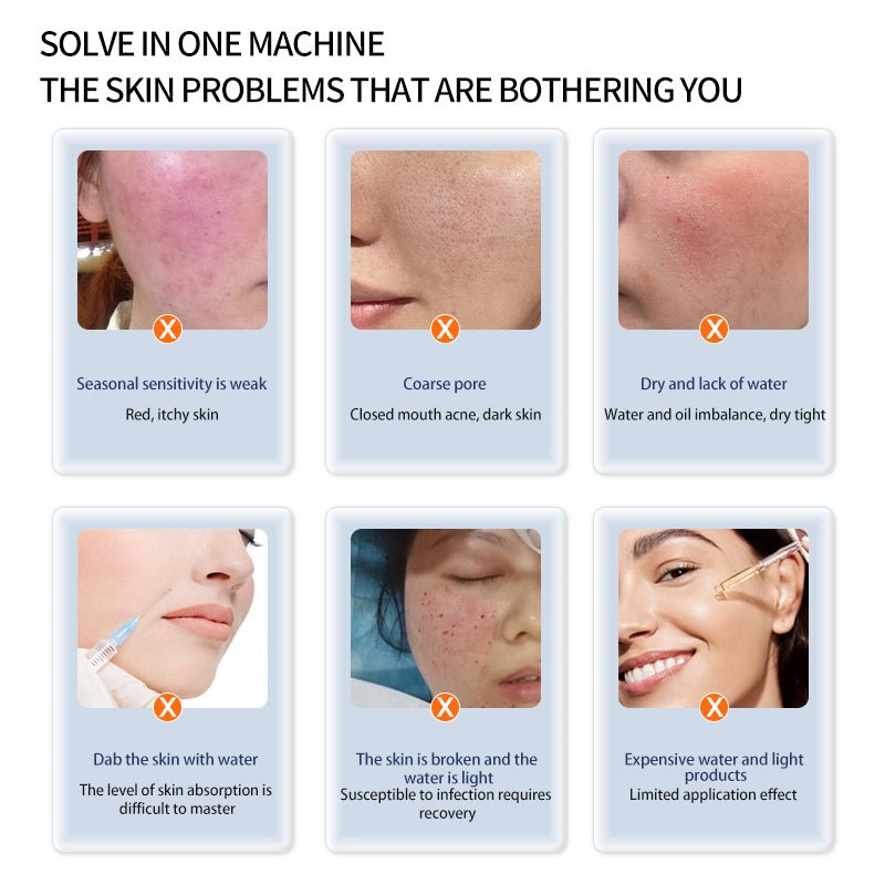 Hello Face3 High Pressure Non-invasive Water Light Instrument Spray Replenishment Introduction Machine - CSTrueBeauty