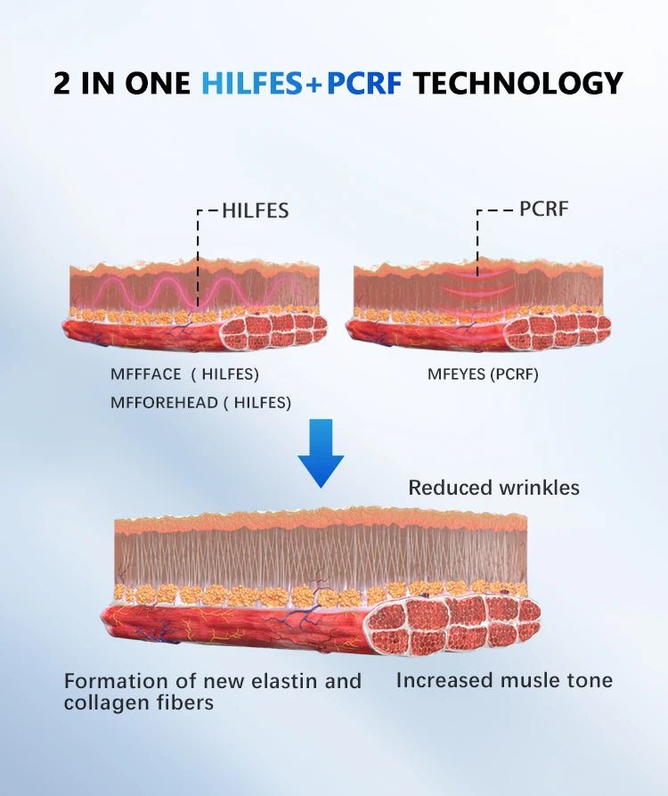 New Technology Non-invasive HILFES PCRF RF Wrinkle Removal MFFFACE Muscle Sculpting EMS Pads Face Lifting Machine - CSTrueBeauty