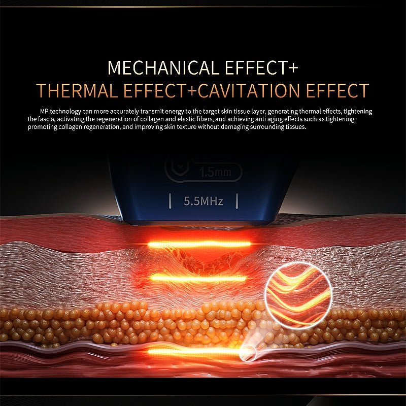 Painless 7D Hifu 9D Hifu TT MPTSTL Machine Device Face Lifting Wrinkle Removal Body Slimming Anti-wrinkle - CSTrueBeauty