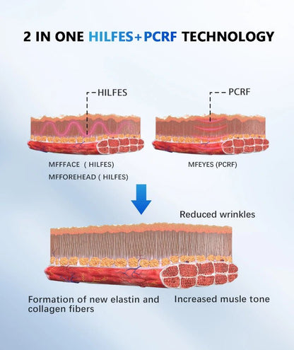 New Technology Non-invasive HILFES PCRF RF Wrinkle Removal MFFFACE Muscle Sculpting EMS Pads Face Lifting Machine - CSTrueBeauty